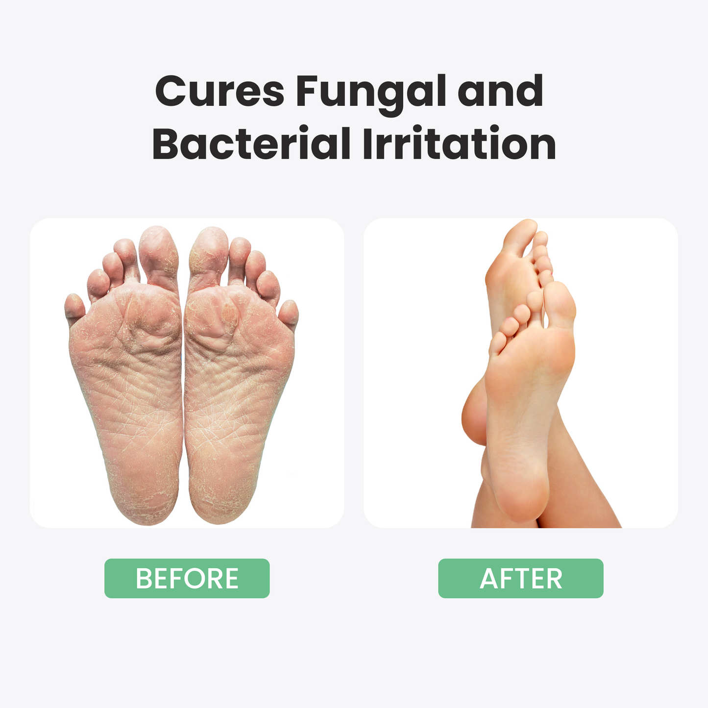 Athletes Foot Treatment Extra Strength - 8.82oz Athletes Foot Cream with Tea Tree Oil And Aloe Vera,Hydrates and Softens for Dry Cracked Feet, Toes and Heel, Alleviating the Foot Odor and Calluses