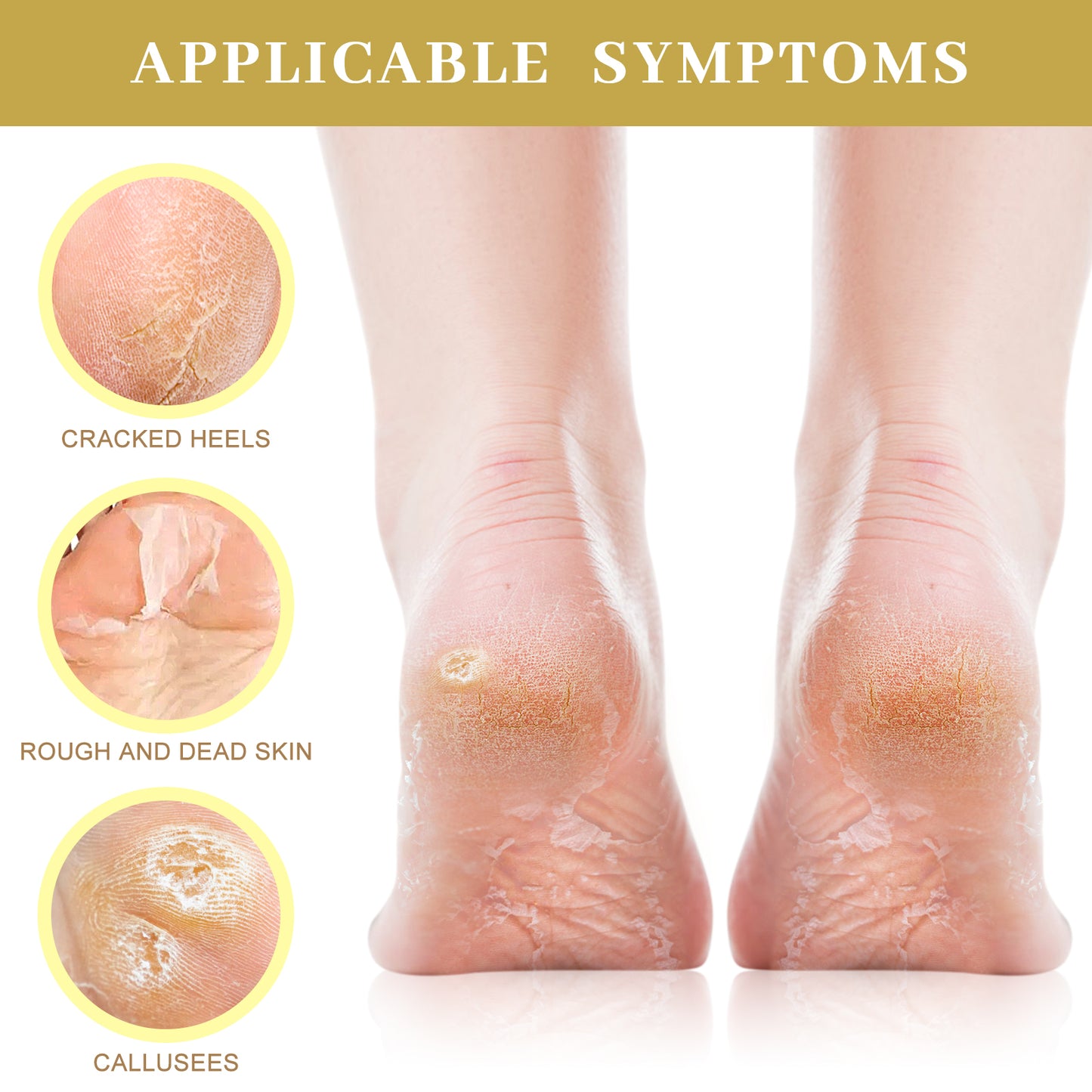 Moisturizing Foot Mask with Shea Butter, Moisturizing Foot Mask for Dry and Cracked Feet, Dry Skin Moisturizer for Soft and Smooth Feet