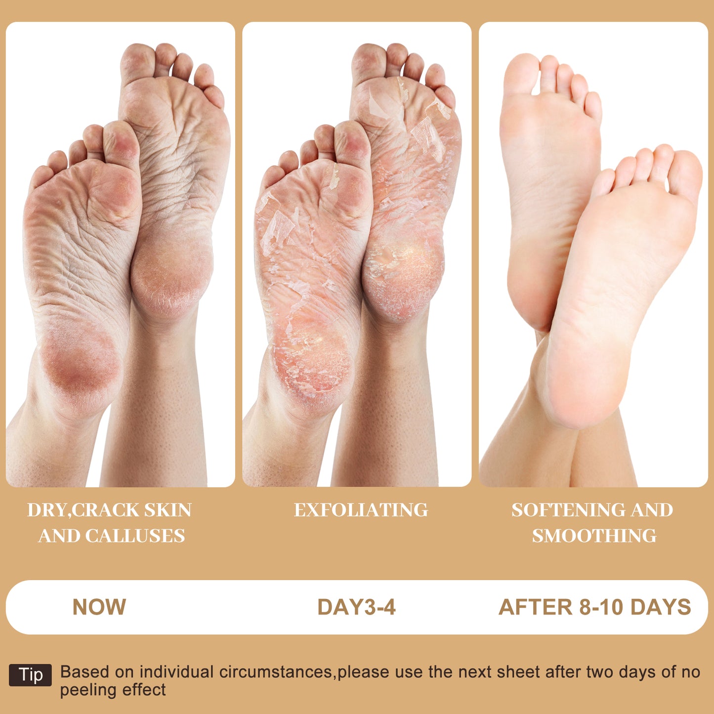 Moisturizing Foot Mask with Coconut, Softens Calluses, Treats Cracked Heels, Soothing & Hydrating