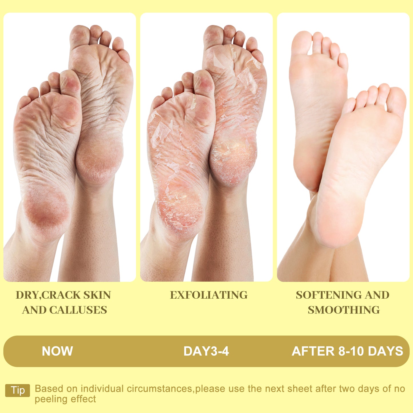 Moisturizing Foot Mask with Shea Butter, Moisturizing Foot Mask for Dry and Cracked Feet, Dry Skin Moisturizer for Soft and Smooth Feet