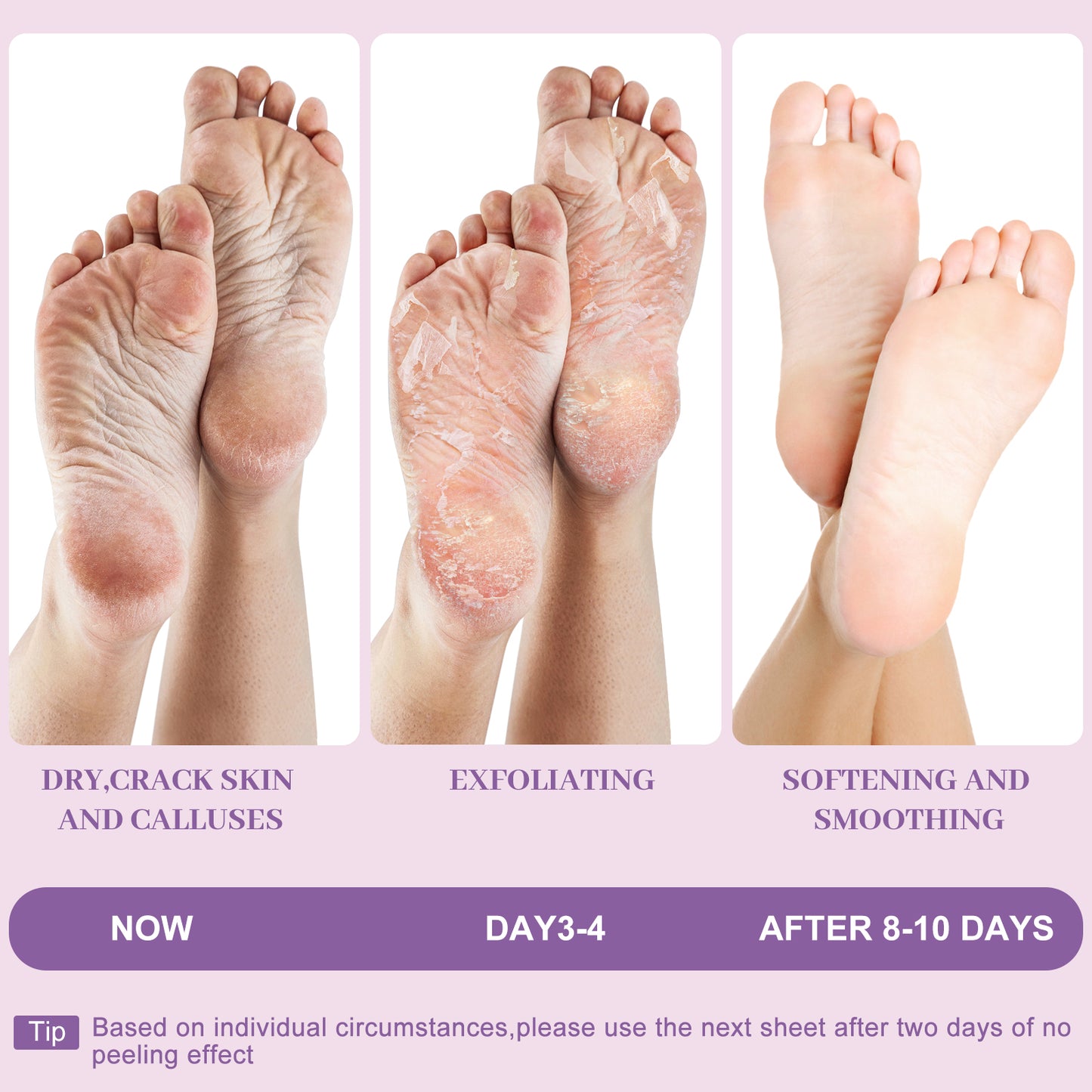 Foot Peel Mask - Pro Callus Remover with Lavender Extract for Rough Cracked Dry Feet-Dead Skin Remove, 3Pairs