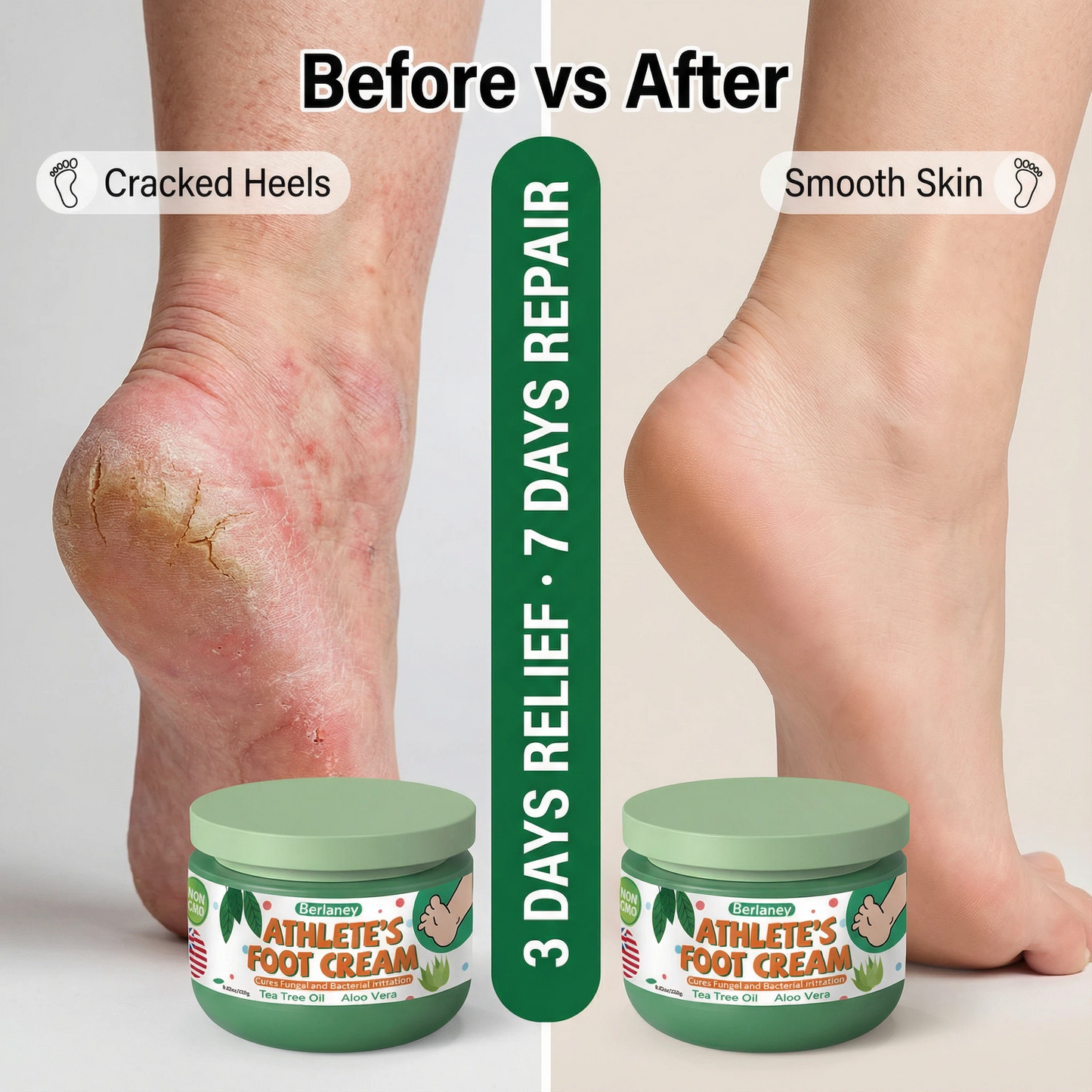 Berlaney Athlete Foot Cream - Tea Tree & Aloe, Itch & Fungal Relief, Dry Cracked Heel Repair, 8.82oz