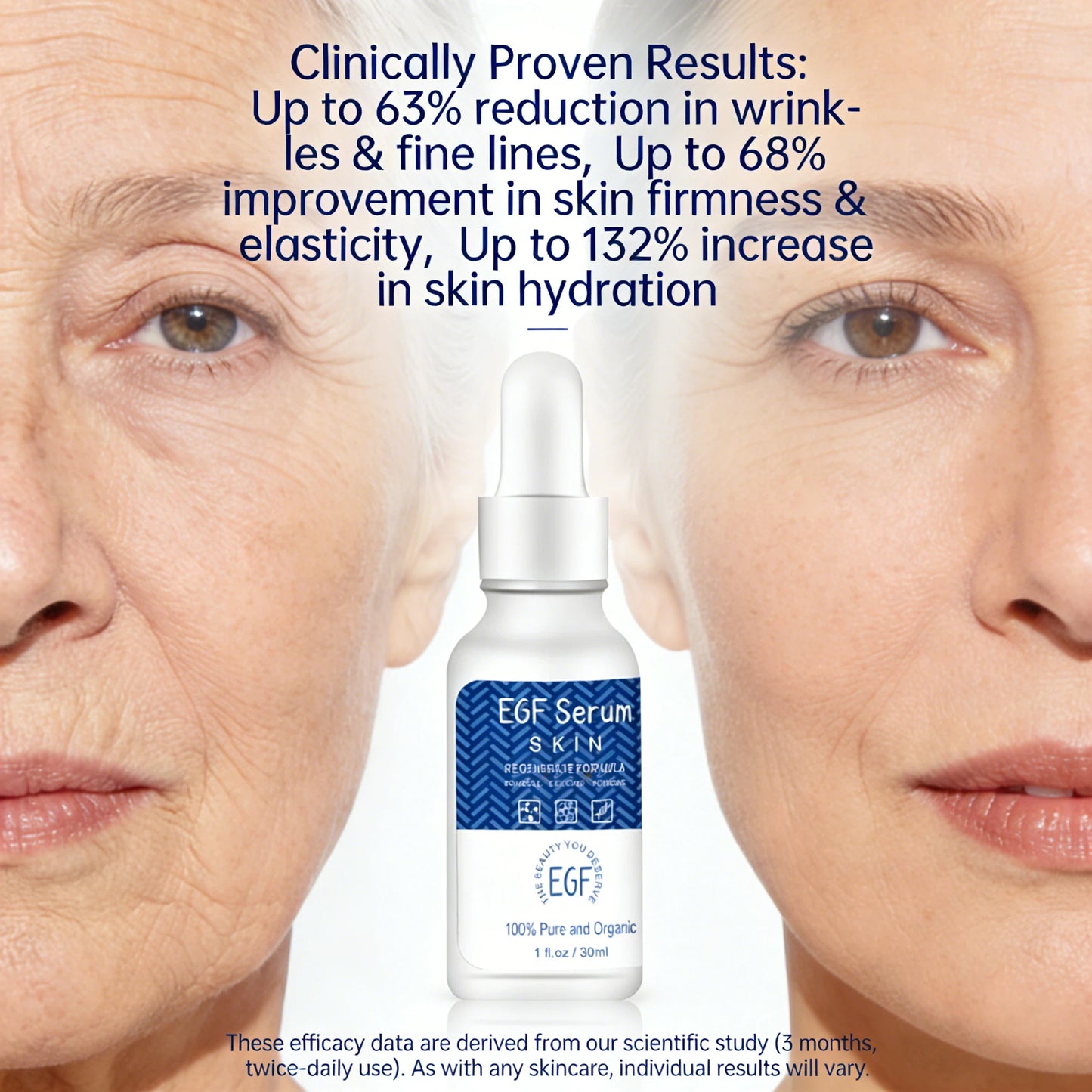 Grocerism EGF Serum - Skin Growth Factor for Tone Improvement, Wrinkle Fading, Moisturizing & Hyperpigmentation Correction - Facial Serum - 30ml