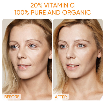 Premium 20% Vitamin C Serum For Face - Boost Skin Collagen,Hydrate & Plump Skin, Anti Aging & Wrinkle Facial Serum 30ml