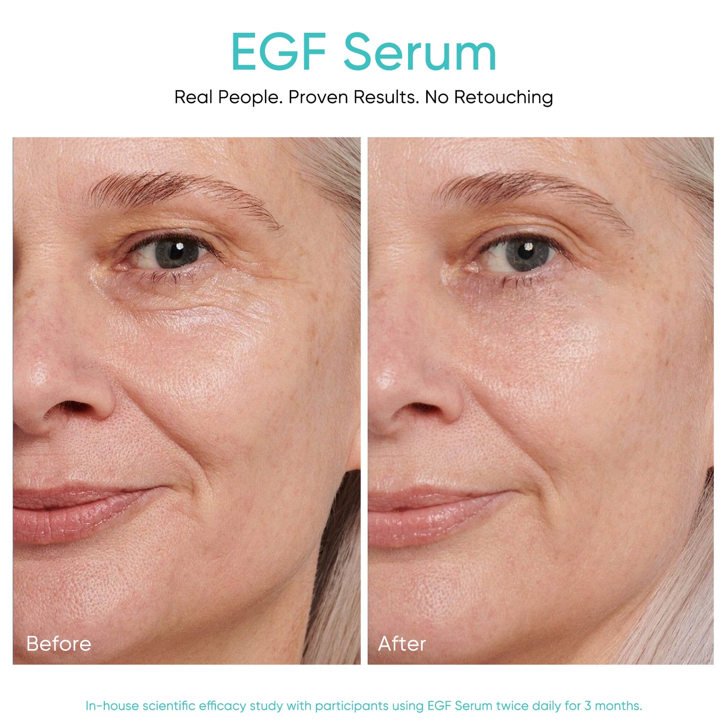 EGF Serum Epidermal Growth Factor 1 Fl. Oz.