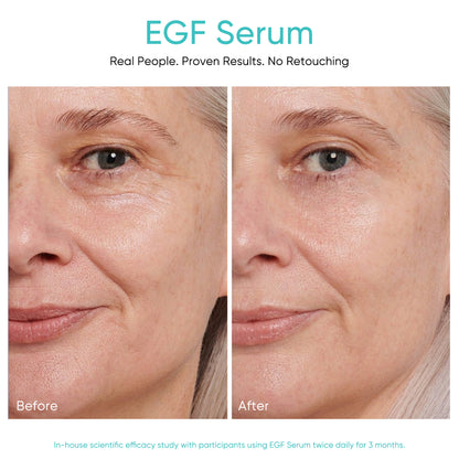 EGF Serum Epidermal Growth Factor 1 Fl. Oz.
