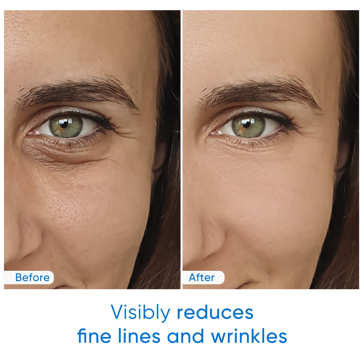 Pure Hyaluronic Acid Serum for Face - Plumping, Anti-Aging, Hydrating - Fragrance-Free - 1 Fl Oz