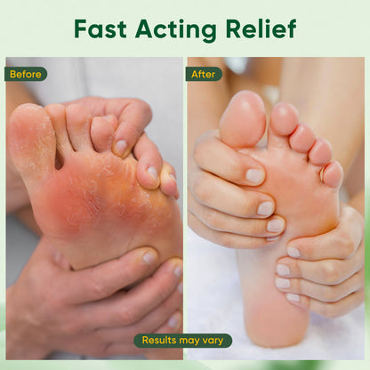 Athletes Foot Treatment Extra Strength - 8.82oz Athletes Foot Cream with Tea Tree Oil And Aloe Vera，Hydrates and Softens for Dry Cracked Feet, Toes and Heel, Alleviating the Foot Odor and Calluses
