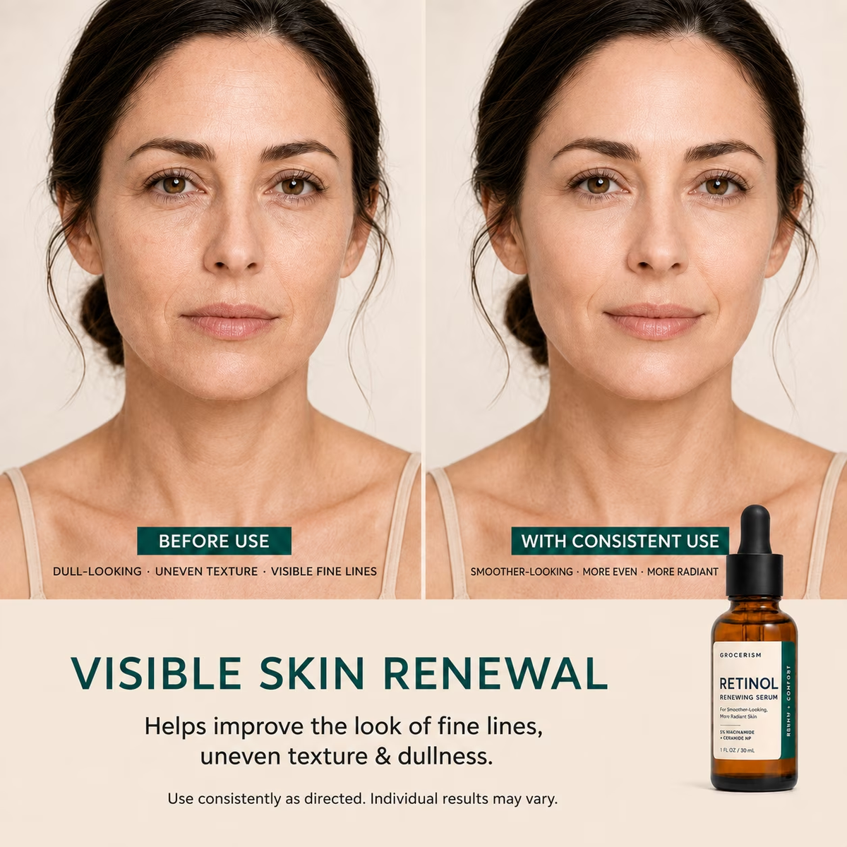 Retinol Renewing Serum for Face, 5% Niacinamide with Ceramide NP & Squalane, Hydrating Anti‑Aging Facial Serum for Fine Lines & Dull Skin 1 fl oz