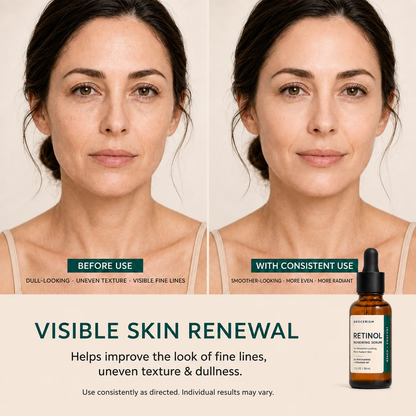 Retinol Renewing Serum for Face, 5% Niacinamide with Ceramide NP & Squalane, Hydrating Anti‑Aging Facial Serum for Fine Lines & Dull Skin 1 fl oz