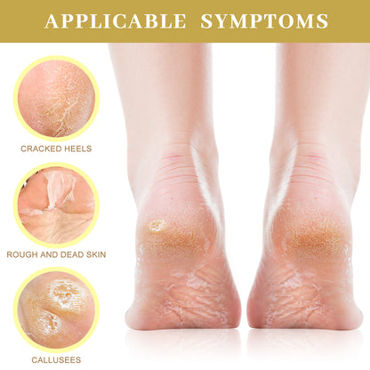 Moisturizing Foot Mask with Shea Butter, Moisturizing Foot Mask for Dry and Cracked Feet, Dry Skin Moisturizer for Soft and Smooth Feet