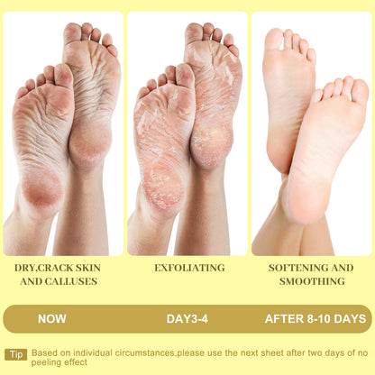 Moisturizing Foot Mask with Shea Butter, Moisturizing Foot Mask for Dry and Cracked Feet, Dry Skin Moisturizer for Soft and Smooth Feet
