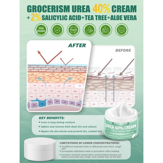 Urea Cream 40 Percent for Feet Plus Salicylic Acid 5.29 oz Foot Cream, with Hyaluronic Acid, Tea Tree,and Aloe Vera for Deep Moisturizes
