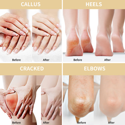 50% Urea Cream for Feet Maximum Strength (with oats and 2% salicylic acid), foot and hand cream with hyaluronic acid, tea tree and aloe vera for deep moisturizing and callus removal