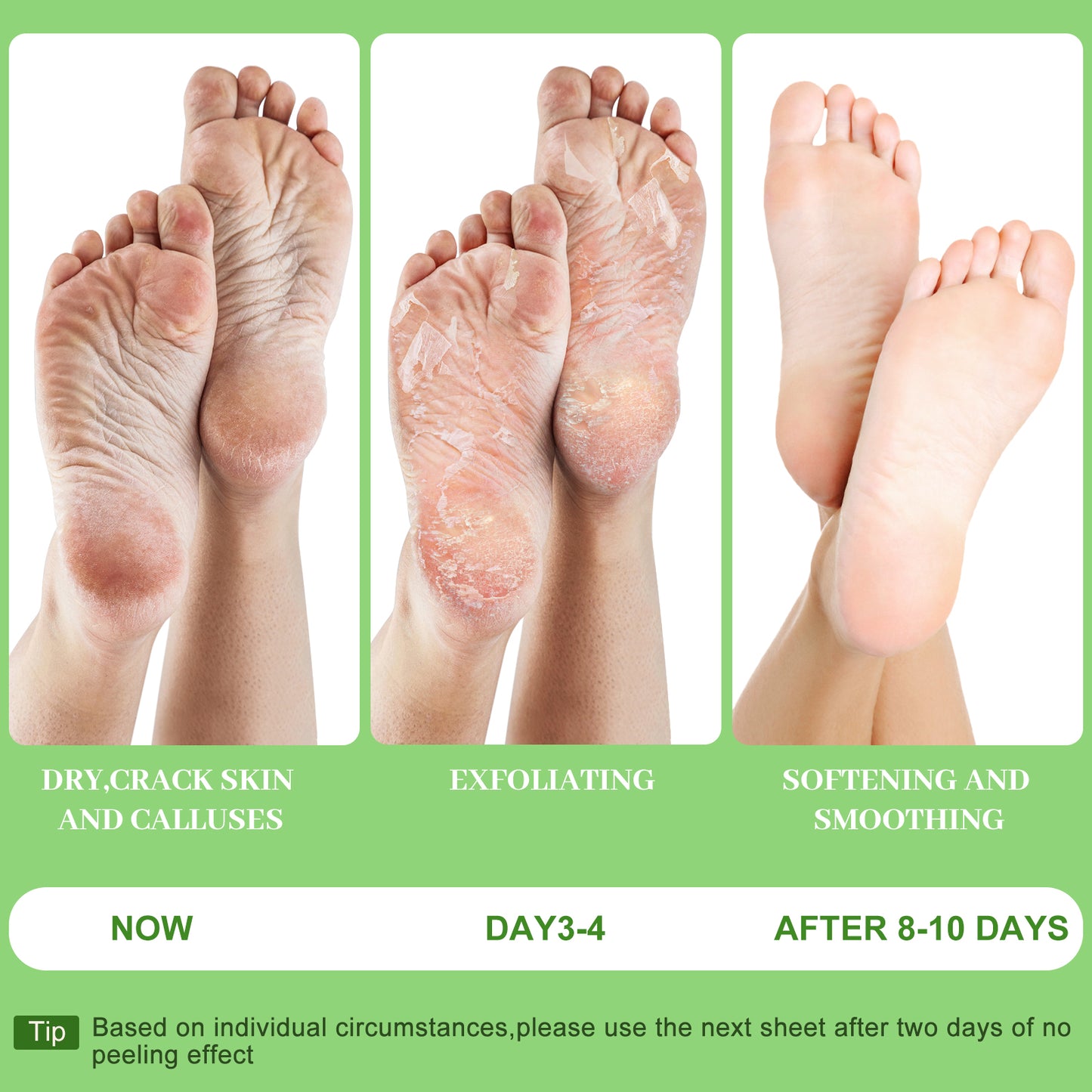 Berlaney Foot Peel Mask, 3 Pairs/Box, Gentle Exfoliation for Rough Feet, Dry Cracked Heels Repair, Unisex Fit, At-Home Foot Spa Care
