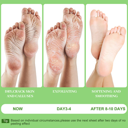Berlaney Foot Peel Mask, 3 Pairs/Box, Gentle Exfoliation for Rough Feet, Dry Cracked Heels Repair, Unisex Fit, At-Home Foot Spa Care