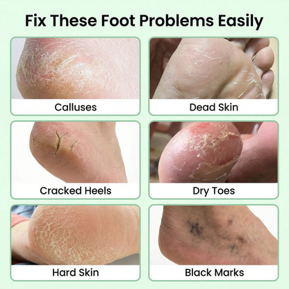 Berlaney Foot Peel Mask, 3 Pairs/Box, Gentle Exfoliation for Rough Feet, Dry Cracked Heels Repair, Unisex Fit, At-Home Foot Spa Care